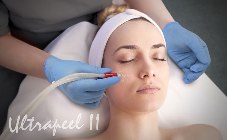 Medical-Microdermabrasion-Ultrapeel-Banner-Image - Good ...